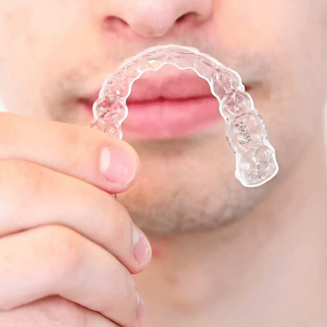 Ortodoncia Invisible vs. Brackets Tradicionales: ¿La mejor opción?