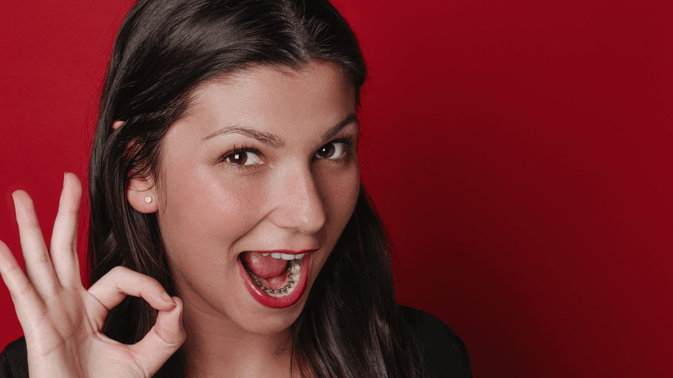 Brackets Invisibles: Cómo mejorar tu sonrisa sin que nadie lo note