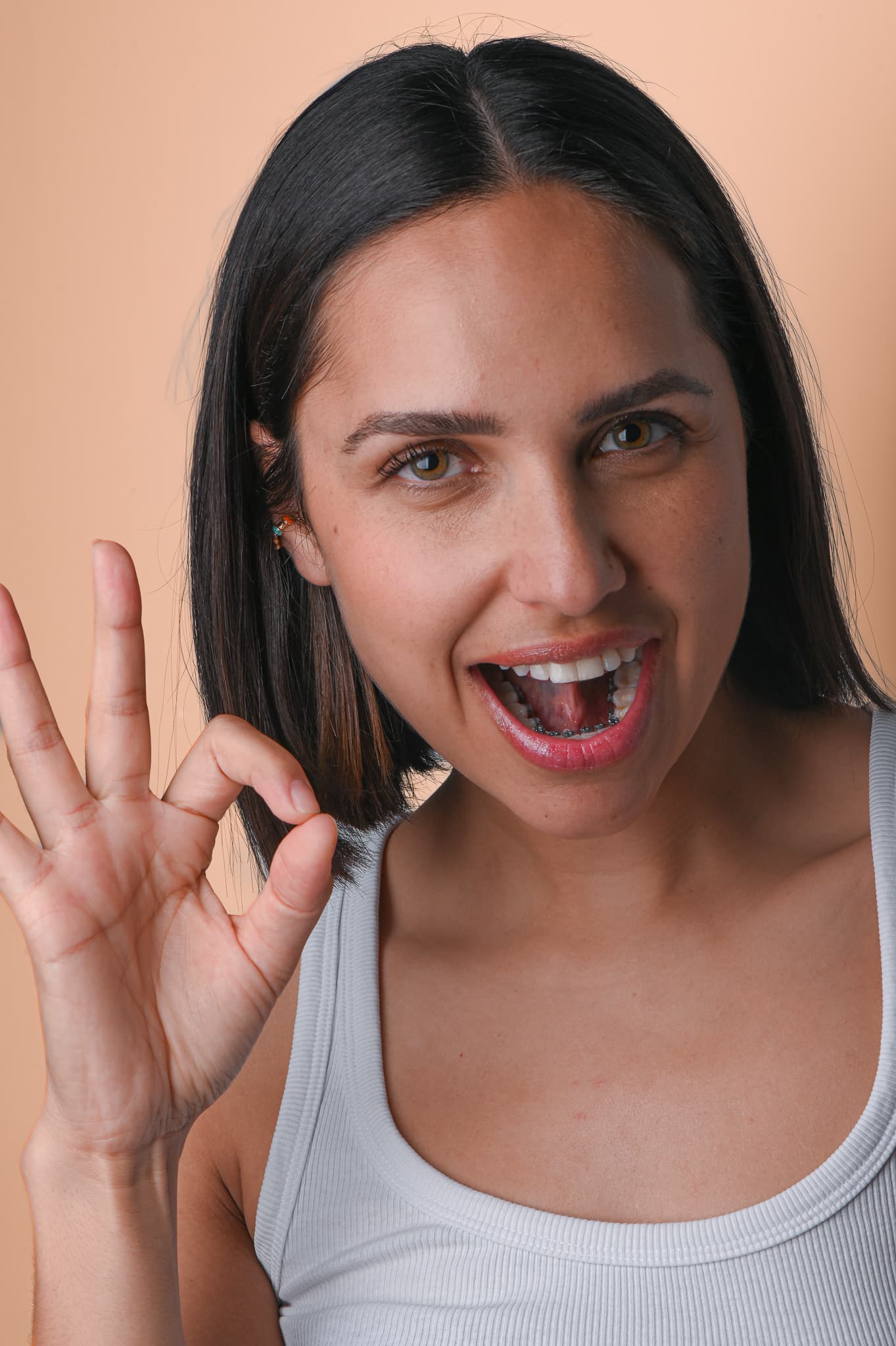 Reembolso Dental con Consorcio en Chile: Lo Que Debes Saber